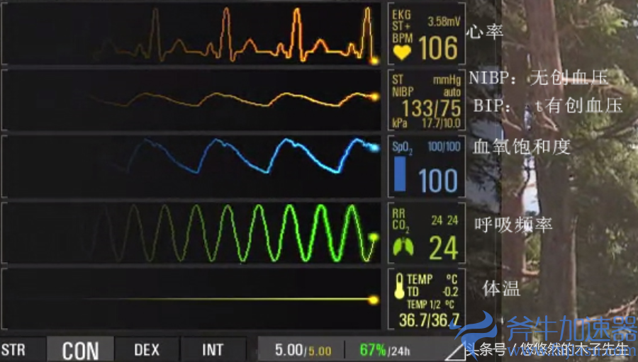scum设置翻译（scum英文设置翻译）(人渣scum设置翻译)
